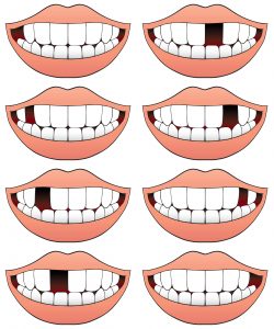 Dibujos de bocas donde falta alguna pieza dental | Clínicas dentales | Clínicas odontología | Apnea del sueño tratamiento